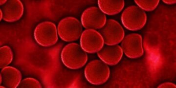 Pengidap Hemofilia terus Meningkat